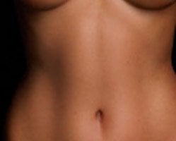 Slider image (4) Dr. Gustavo Yanez - Plastic Surgeon